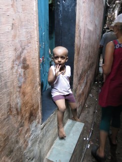 Curious slum child - head shaved for lice