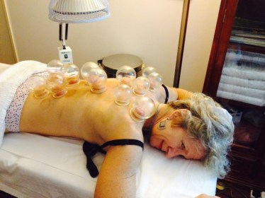 cupping1